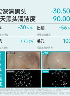 【毛孔进阶护理】ilso黑头导出液去黑头水院线收缩毛孔深层清洁女