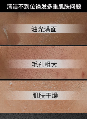 澳本初温和清洁毛孔控油洗面奶