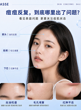 秾华施微晶祛痘贴9粒装