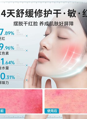 丽素丽速重组三型人源化胶原蛋白敷贴补水抗皱术后面膜
