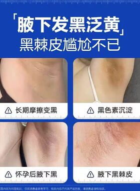 肥胖腋下神器腋窝除黑色素排黑色素沉淀淡化去除膏CS