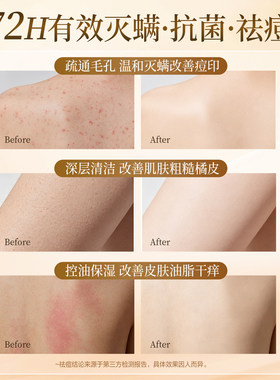 纳爱斯硫磺液体香皂净痘除螨清爽控油止痒洗脸洗发男女官方