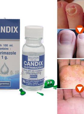 CANDIX灰指水见效快,效果好