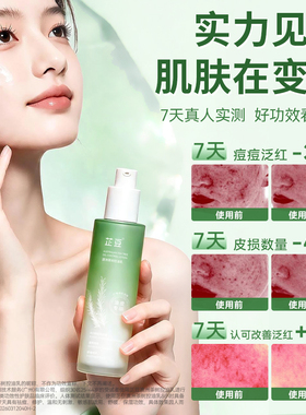 芷豆祛痘乳茶树修护控油清爽补水保湿舒缓痘肌褪红秋冬乳液青少年