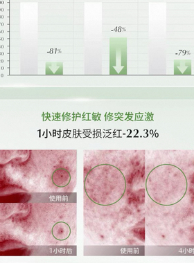 Yao企专为敏豆闭口肌-冷翡翠油！拍四299/拍十仅599私主播