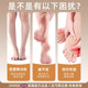 Foot arch training device correction