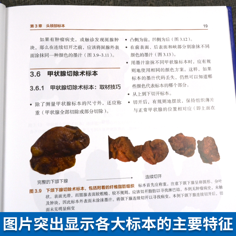 外科病理取材图谱 乳房切除术标本 皮肤切除术标本 肿块切除术标本 扁桃体切除术标本 前哨淋巴结标本 舌切除术标本 息肉切除术 - 图2