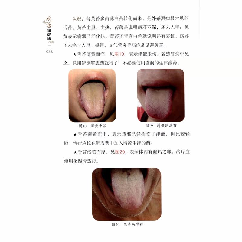 观舌知健康从零开始学舌诊中医学高清彩图一看就懂家庭医生舌诊书籍舌诊辩证图解儿童成人舌诊多种常见病舌诊中医养生书籍_虎窝淘
