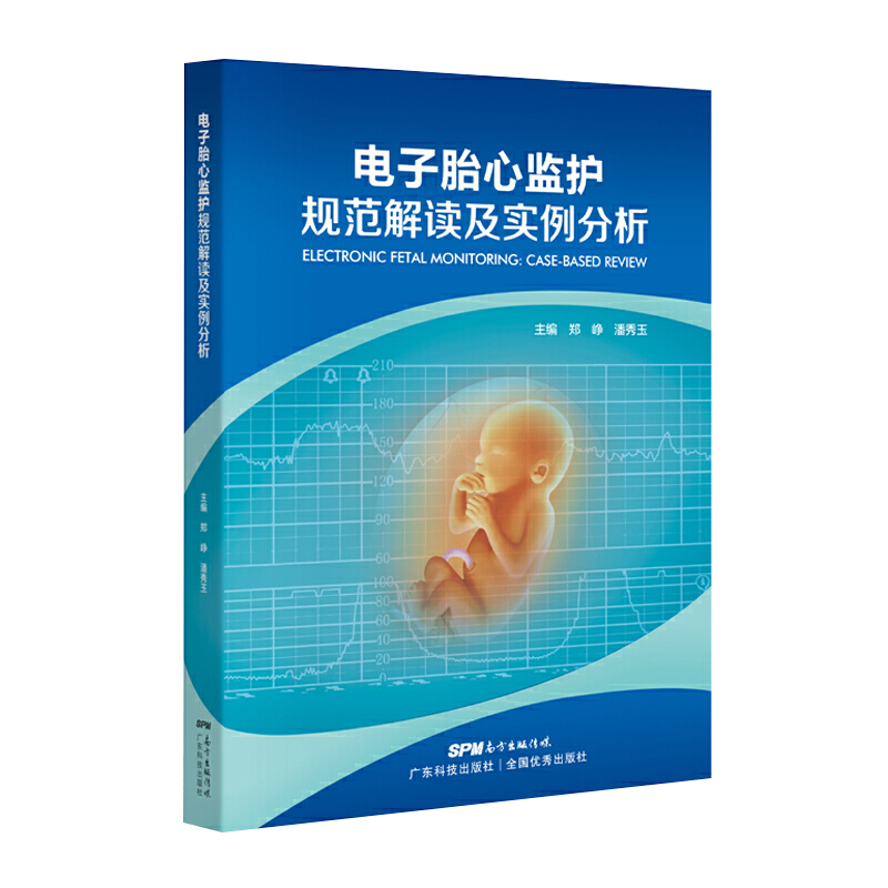 电子胎心监护规范解读及实例分析 临床实用胎儿电子监护学超声心动图学实用指南胎监书连续电子胎心监护规范判读胎儿异常妇产科学 - 图3