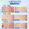 Lishui Spring B5 Repair Cream