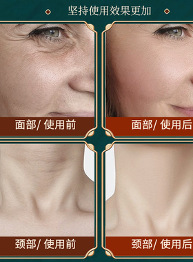 刮痧板刮脖子神器颈纹淋巴刮痧专用按摩肩颈腿背部全身树脂刮痧铲
