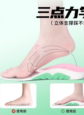 扁平足鞋垫男女足弓支撑减震运动