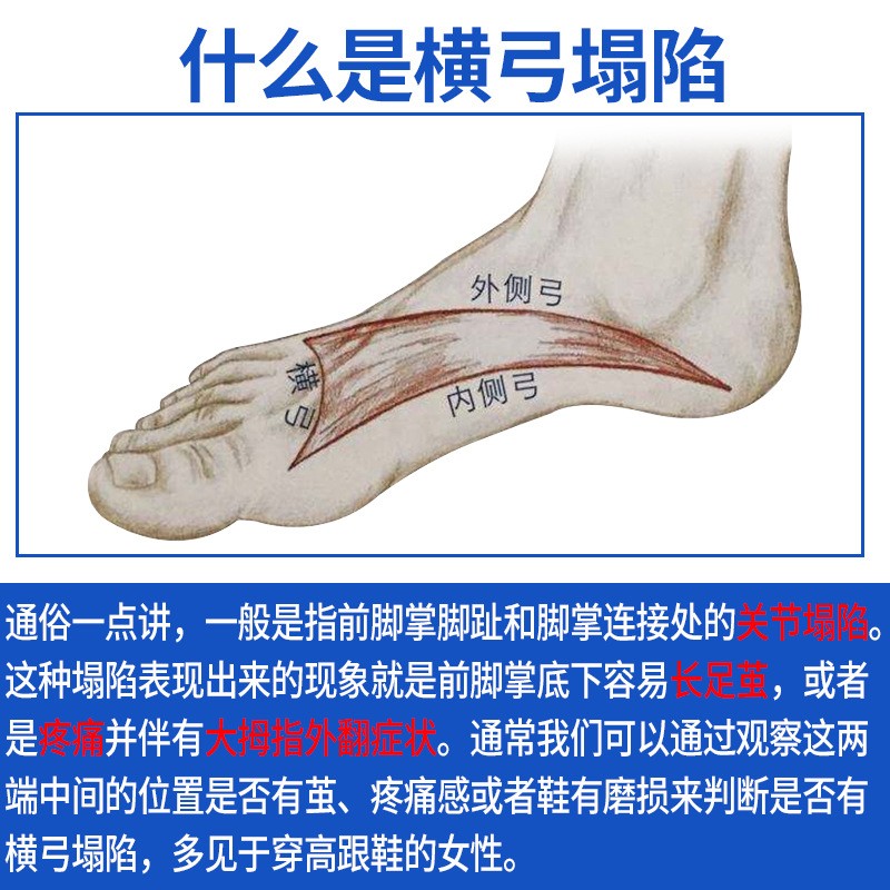 拇外翻鞋垫矫形足弓支撑缓解前掌疼痛男女扁横弓塌陷矫正鞋垫 - 图0