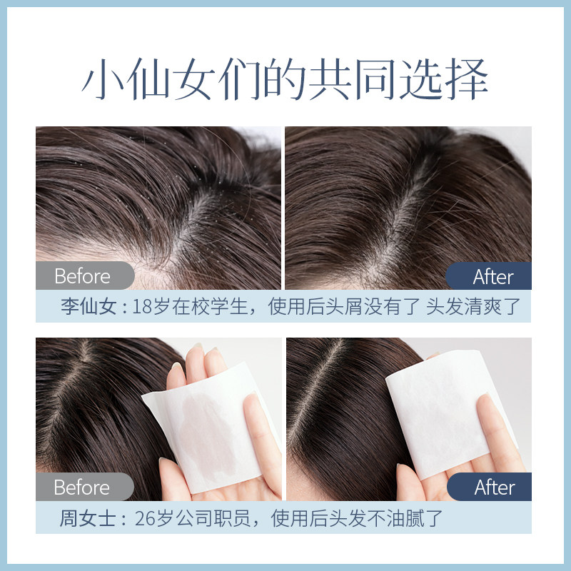 丝芬海盐除螨香氛去屑止痒洗头膏 丝芬洗发水