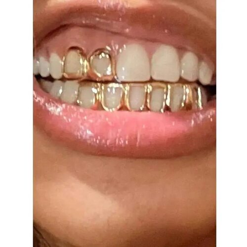 1 Set Fashion Womens Dental Grillz Double Hollow Heart - 图0