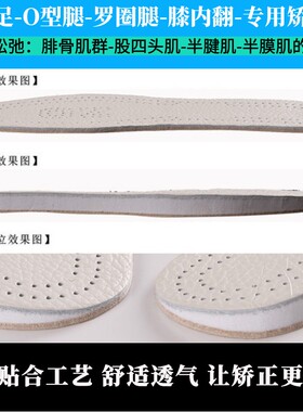 O型腿足内翻马蒂足八字矫正鞋垫