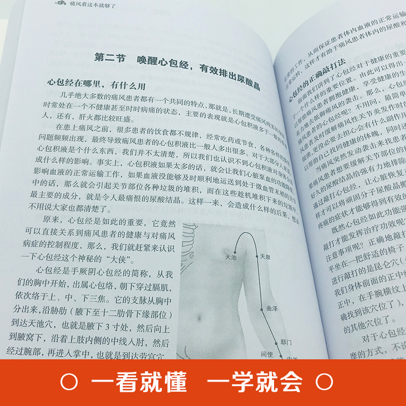 正版 痛风看这本就够了 痛风食谱书饮食宜忌食疗食谱痛风自查症状疼痛缓解方法痛风按摩刮痧艾灸方法 告别痛风 中医养生书籍大全 - 图1