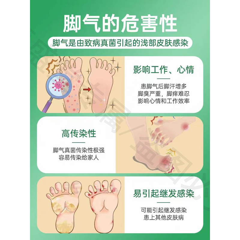 蛇毒脚气膏止痒脱皮杀菌烂脚痒足部护理膏清爽舒适（非进口）