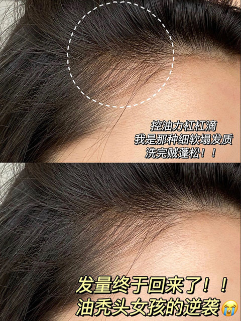 美国revlon露华浓生姜洗发水护发素去屑止痒控油无硅油防脱发男女