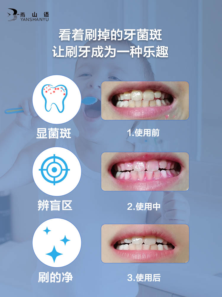 燕山语奥拉氟儿童牙膏3~6~14岁含氟防蛀防龋齿修复可视牙菌斑显色-第5张图片-提都小院