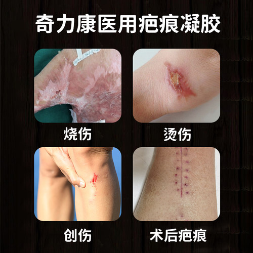奇力康 医用疤痕软膏 愈合期烧伤手术后疤痕的辅助改善 - 图1