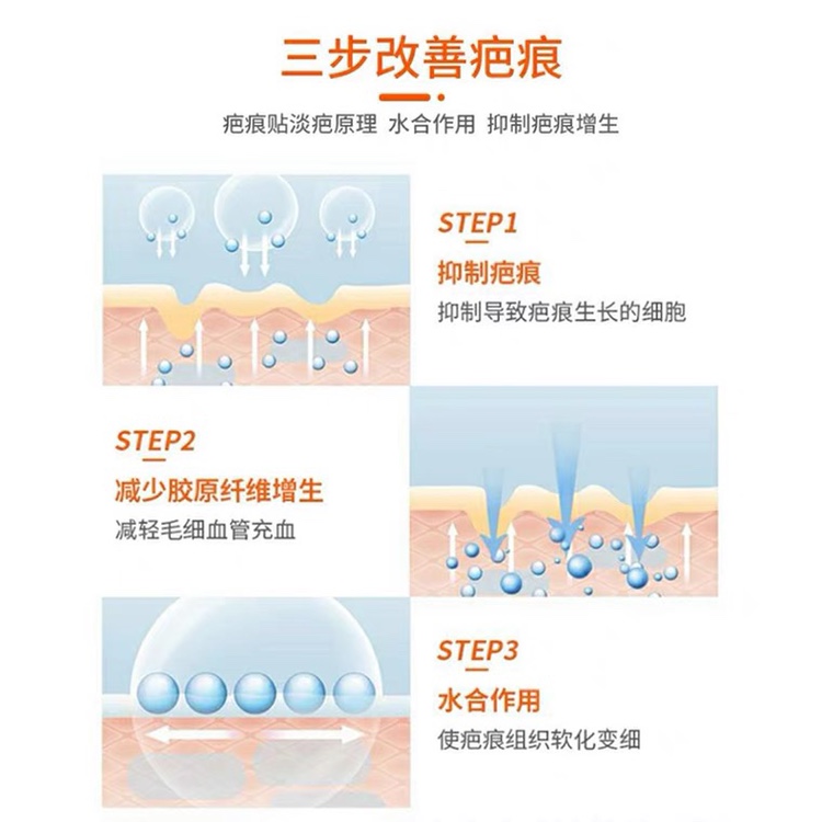 疤痕贴开眼角点痣剖腹产手术疤增生疤美皮护理舒痕贴4x15cm试用装 - 图0