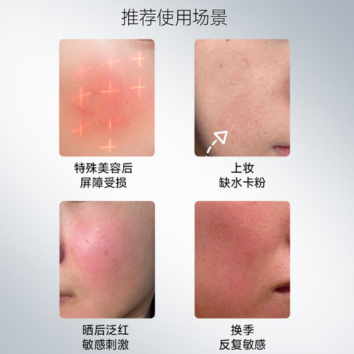优斐斯倍润修护面膜神经酰胺深层补水保湿修护肌肤屏障缓解敏感 - 图1
