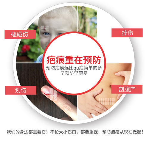 进口3M剖腹产手术1545PP美容免缝胶带疤痕贴减张预防疤痕 - 图1