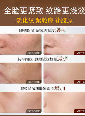 OSAL白细胞活素透肌抗皱面霜