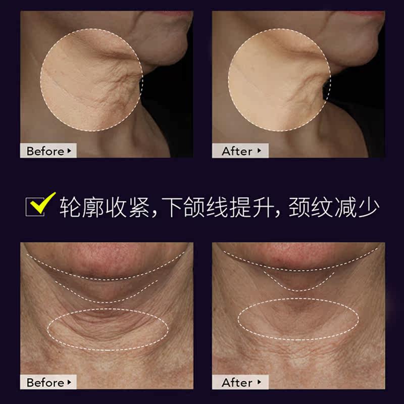 2019克星薇娅推荐去颈纹神器颈霜 娜贝尔颈霜