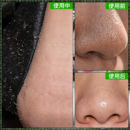 Полоска для носа от черных точек