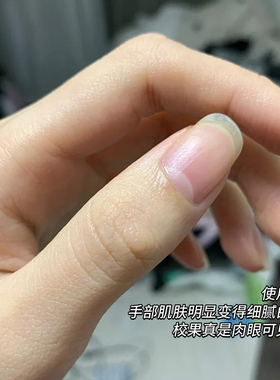 LuckyTrendy手膜足膜保湿嫩白
