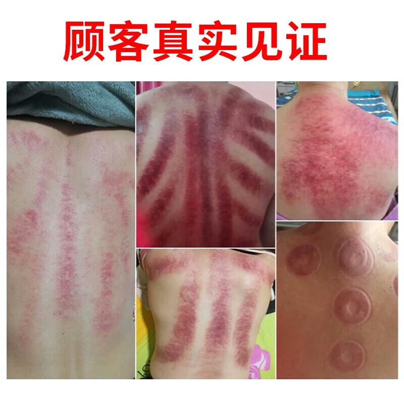 刮痧仪器家用疏通经络排毒仪电动吸痧机理疗无线全身通用拔罐充电_虎窝淘