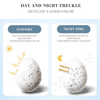 Whitening Freckle Cream Remove Melasma Cream Remove Dark Spo