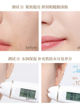 Elastic Gold Protein Peptide Set Lifting and Tightening Fadi