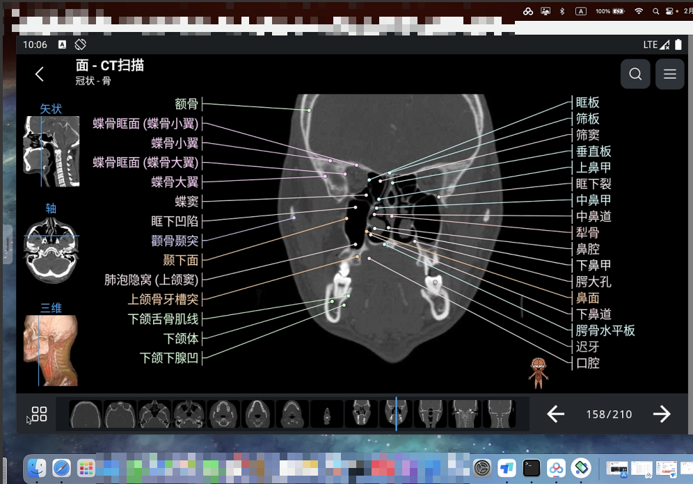 e-Anatomy解剖图集中文永久win安卓mac都能eanatomy（医生优惠） - 图3