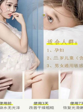 身体乳液补水面霜滋润舒缓套装