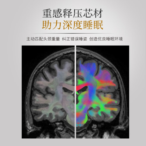 BECKY枕头护颈椎助睡眠颈椎枕护颈枕成人慢回弹记忆棉侧睡家用 - 图2