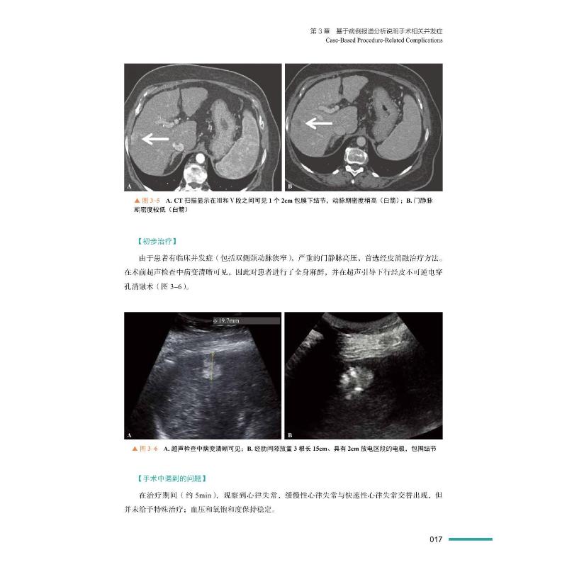 非血管介入治疗与肿瘤介入并发症 基于病例的解决方案 (德)斯特凡·穆勒-赫尔斯贝克,(德)托马斯·扬克 著 丁晓毅 译 医学其它