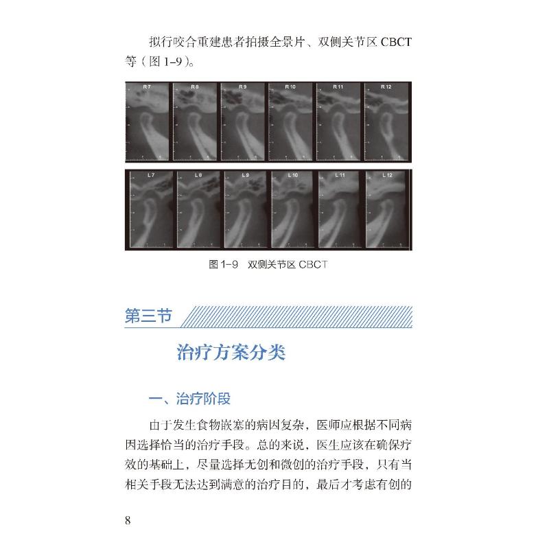 食物嵌塞的修复治疗 图解口腔美学种植修复临床规范丛书 于海洋 可搭配赝复体治疗修复预告技术规范牙科比色操作手册 - 图0