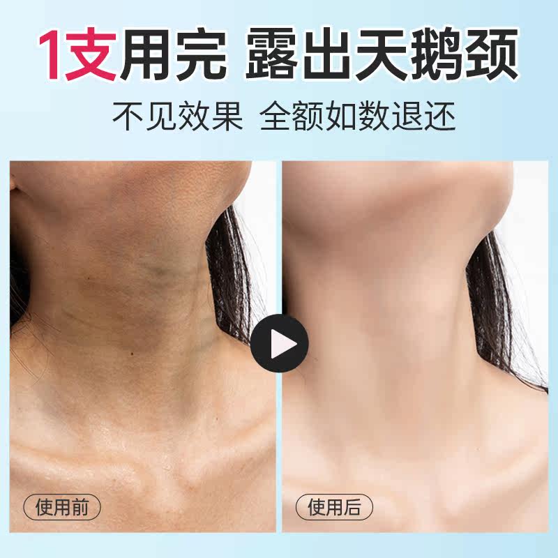 颈纹霜去颈纹紧致带滚轮神器美颈霜 儒意化妆品颈霜