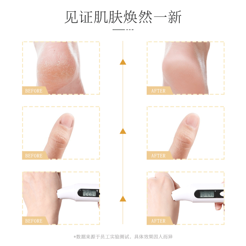 凡士林脚后跟干裂皲裂脱皮防开裂口护手足脚裂膏去死皮龟裂修护霜 - 图1