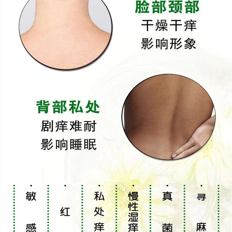 皮肤瘙痒止痒外用毛囊炎儿童ww喷剂 仁济大药房皮肤消毒护理（消）