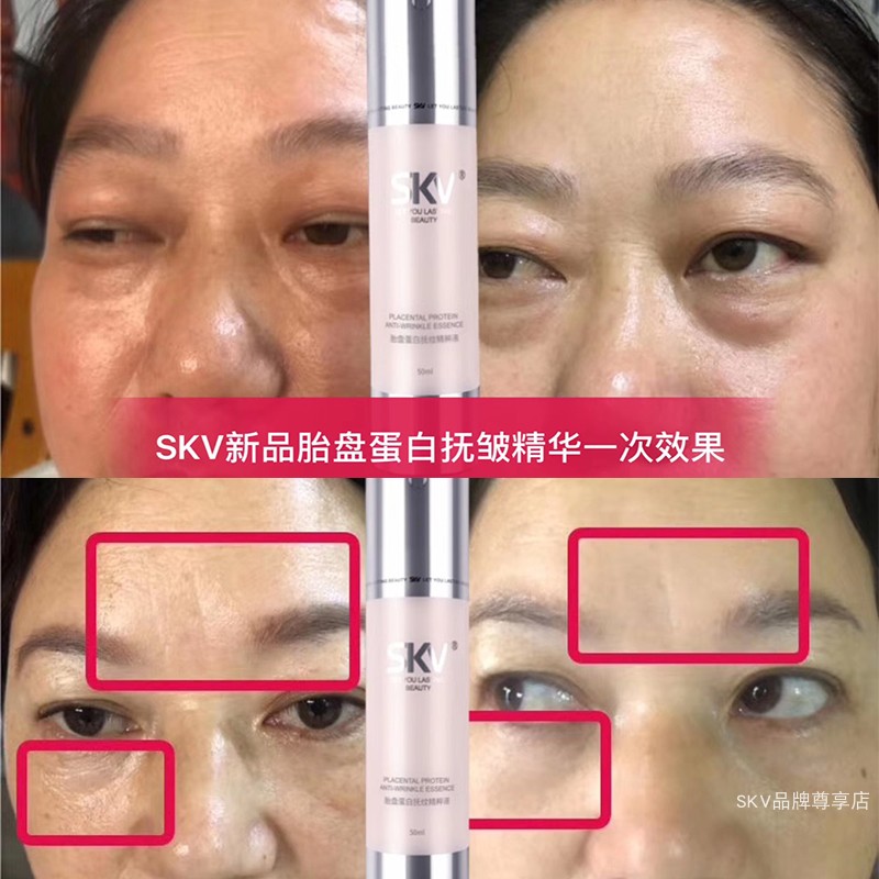 SKV胎盘蛋白抚纹精粹液淡化细纹保湿补水光滑肌肤紧致男女正品-图1