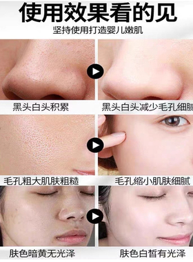 【排黑膏】脸部黑收缩毛孔黑头