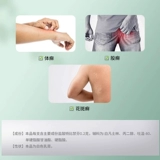 丁克 Тербинафиновый гидрохлоридный крем 10 г/20 г ручной и ноги грибковой инфекция