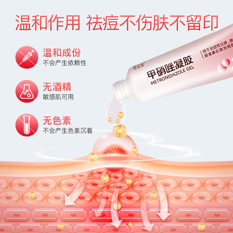 喜辽妥甲硝唑凝胶20g 祛痘脓胞疮酒渣鼻红斑炎症丘疹非痘印非淡化