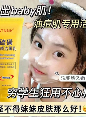 洗面奶硫磺止痒净螨控油祛痘印