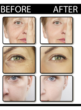 FaceSerumSkinCare精华液