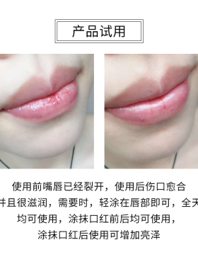 近江兄弟儿童男士保湿薄荷润唇膏